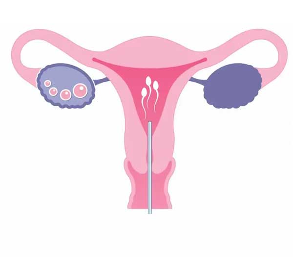 Best IVF & Infertility Specialist in Gurugram Best IVF Centre, Gurugram