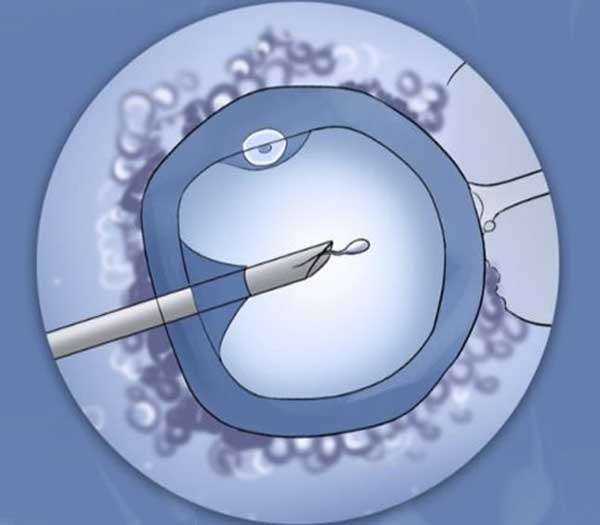 Best IVF Centre, Gurugram