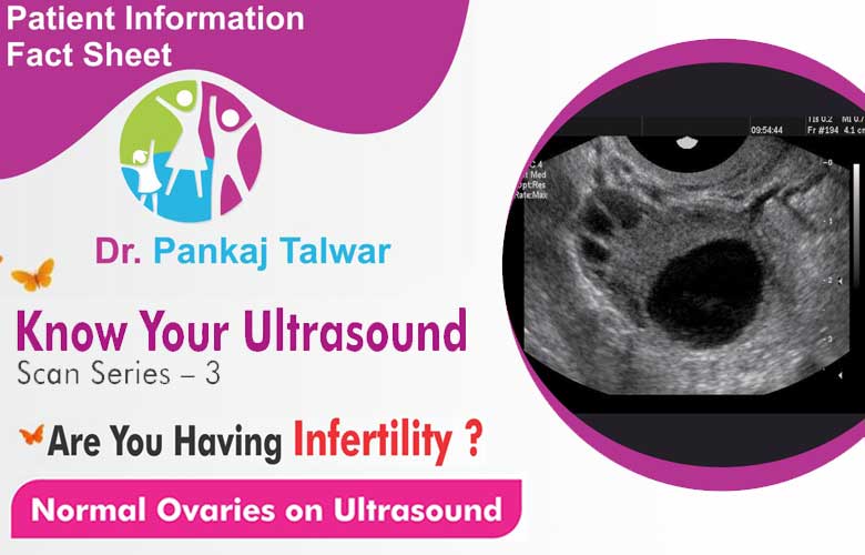 Normal Ovaries on Ultrasound by Dr. Pankaj Talwar