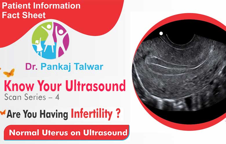 Normal Uterus on Ultrasound