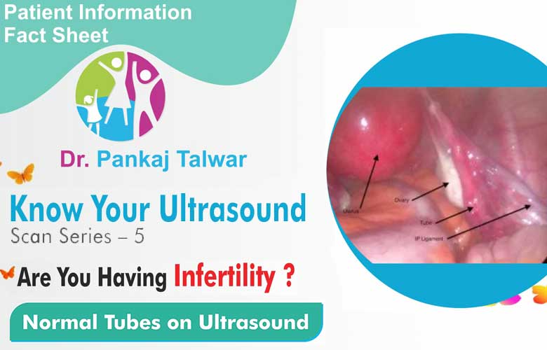Normal Tubes on Ultrasound
