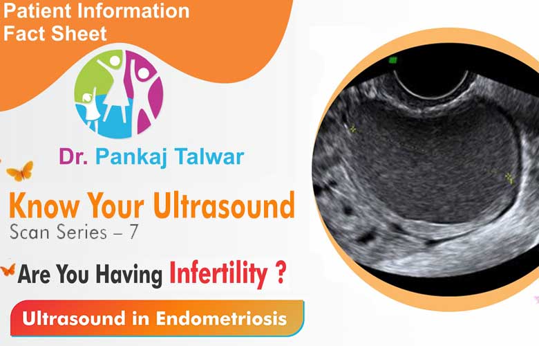 Ultrasound in Endometriosis