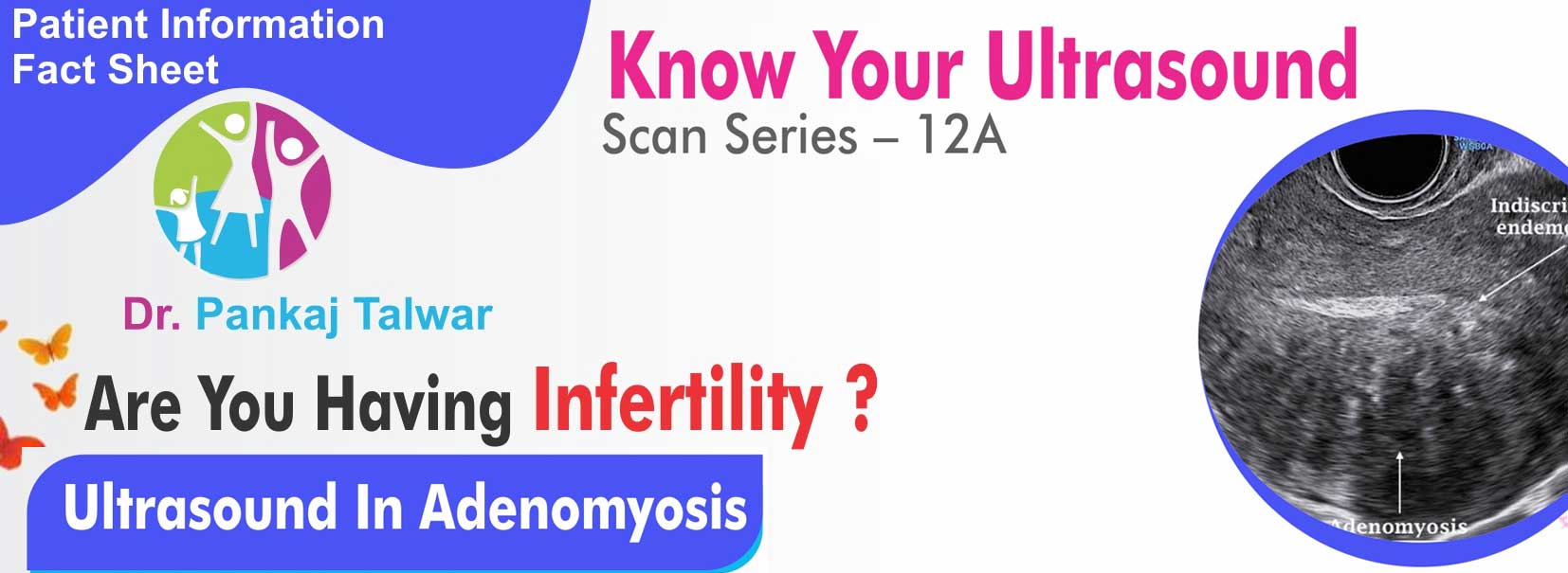 Ultrasound In Adenomyosis
