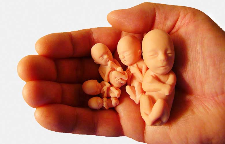 Recurrent Miscarriages