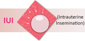 Dr Pankaj Talwar - IUI Services