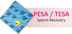 Sperm Recovery Services