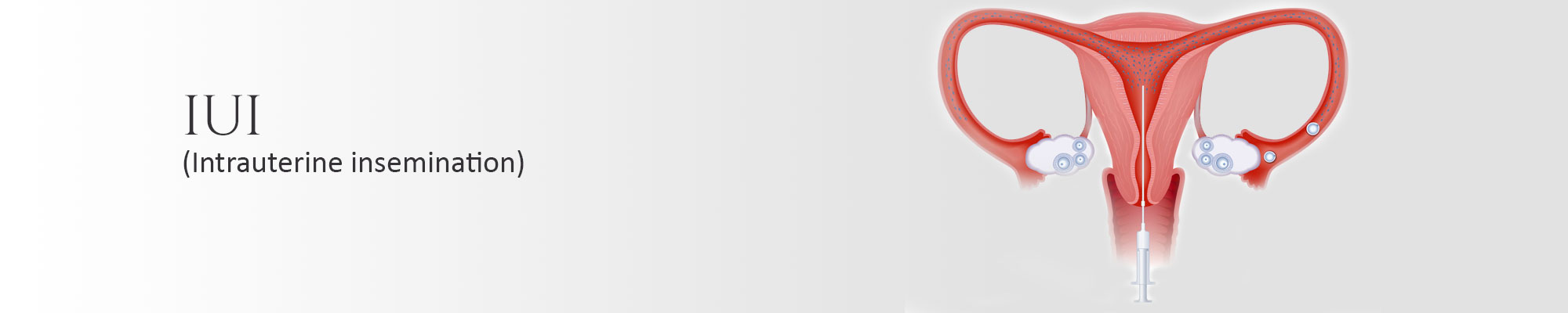 IUI Specialist Centre Delhi
