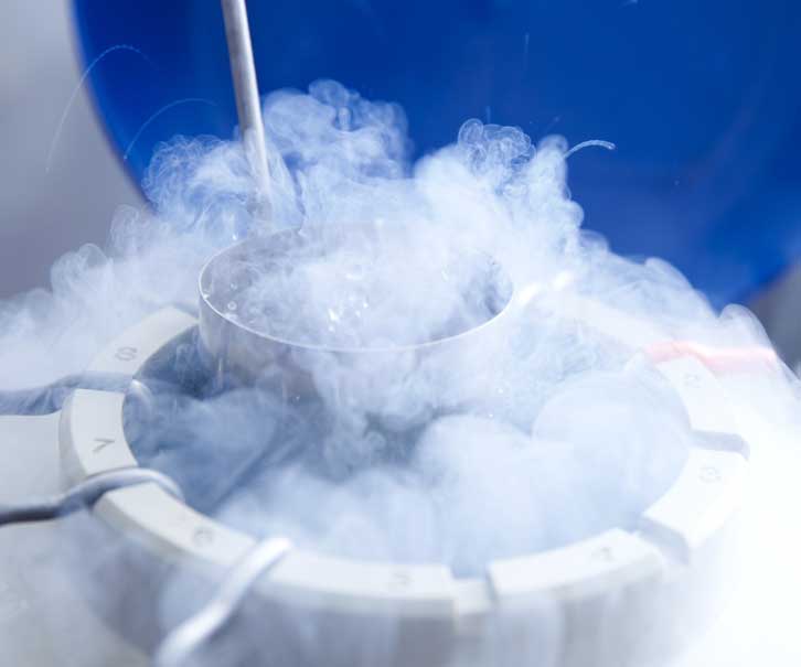 Semen Freezing