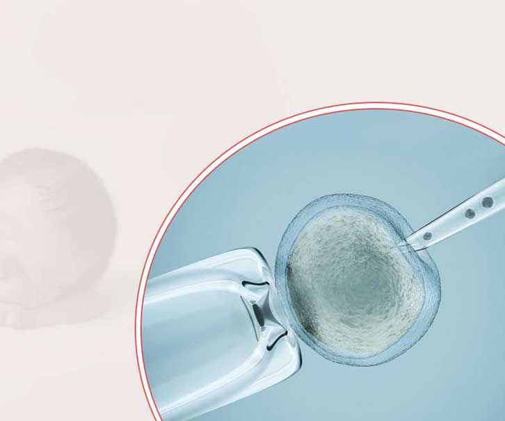 5reasons ivf