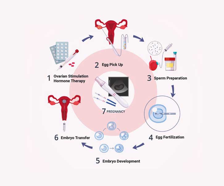 process of IVF step1
