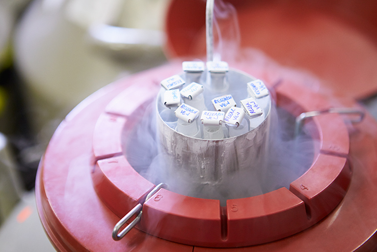 Sperm Freezing in Gurugram